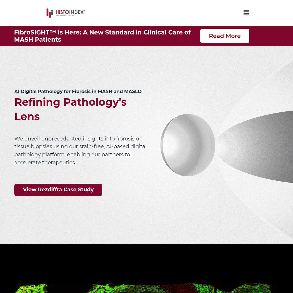 HistoIndex raises SGD9M to revolutionize digital pathology solutions