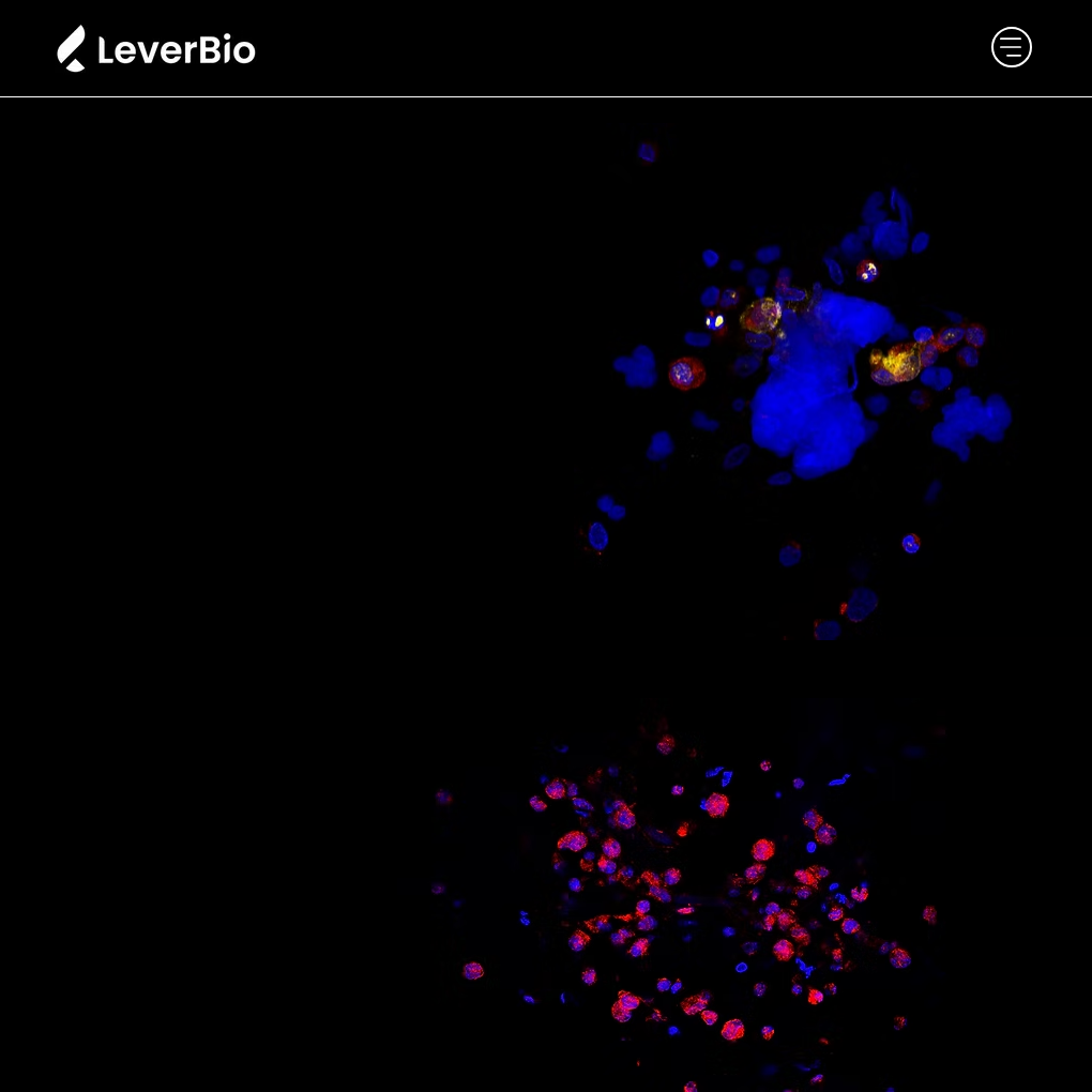 Lever Bio raises €4M to advance immuno-oncology therapies